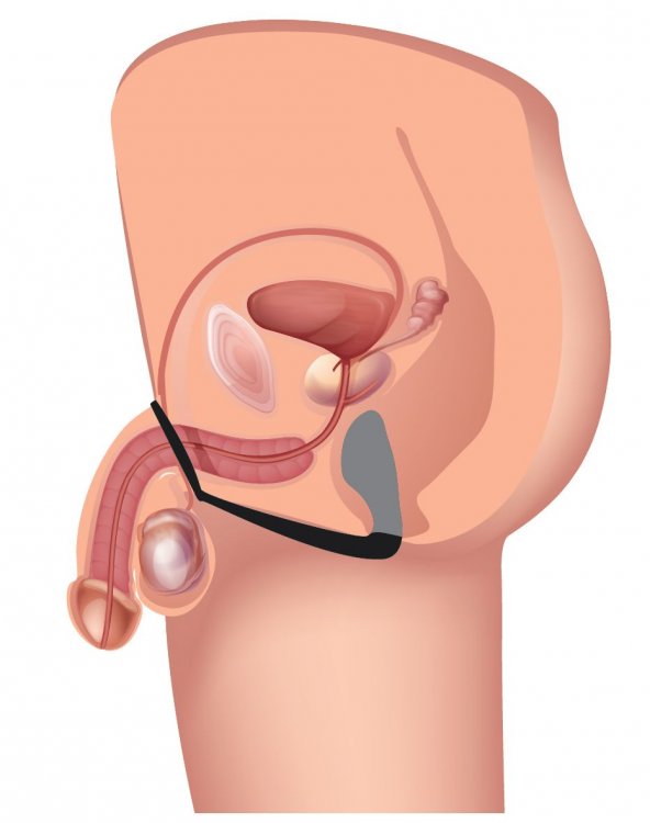 Prostatic Play Stimulator W/ Cock & Ball Strap